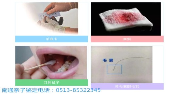 南通景盛生物专业亲子鉴定/南通个人亲子鉴定怎么做？