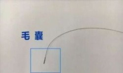 头发小图 头发小图