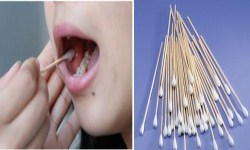 口腔拭子样本 口腔拭子样本