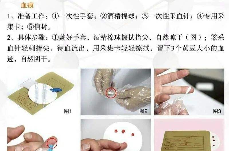 血痕采集 血痕采集